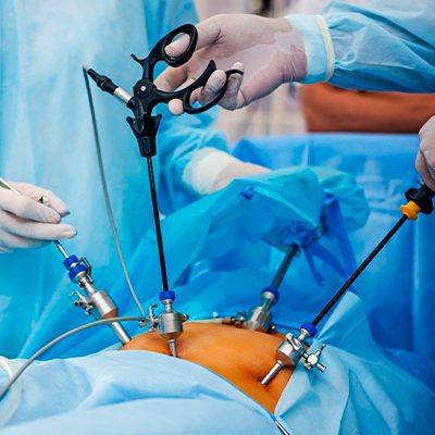 Sem Vesícula? O Que Pode Mudar Na Sua Vida Após A Cirurgia