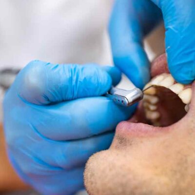 Novembro Vermelho: câncer de boca está entre os mais incidentes no Brasil